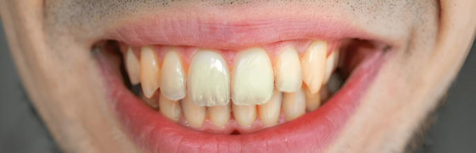 Dental center Yellow Teeth