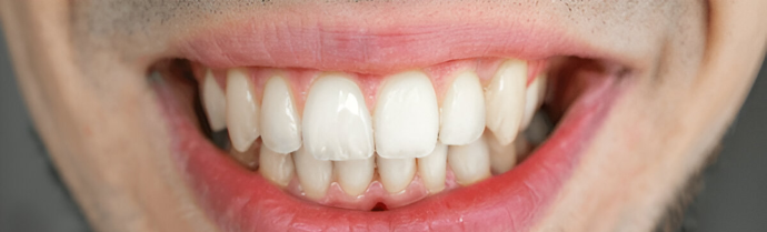 Dental clinic Teeth Whitening