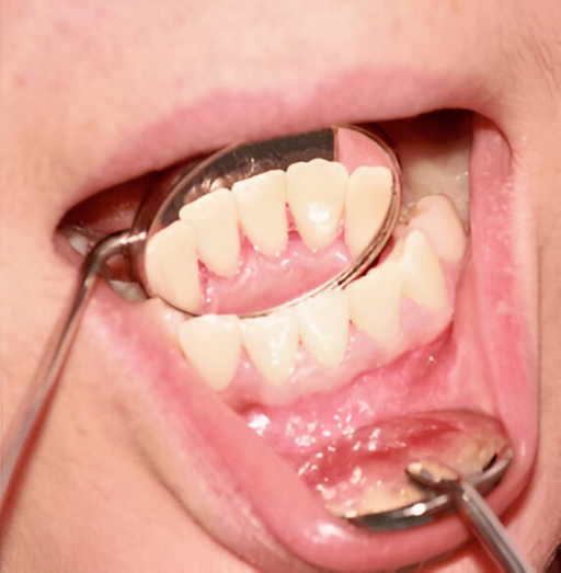 Dental center Teeth Whitening