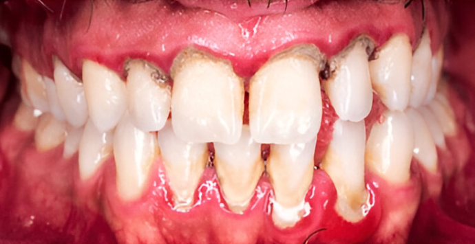 Dental Clinic Teeth Discoloration
