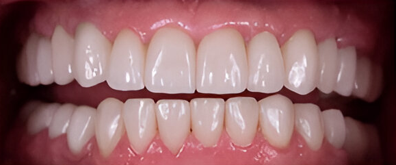 Dental Center Painless Dental Procedures