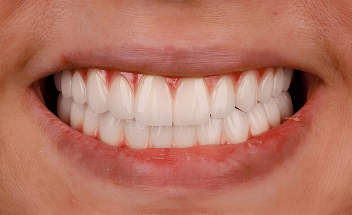 Dental center Actors teeth