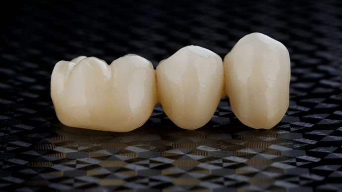 Dental Crown