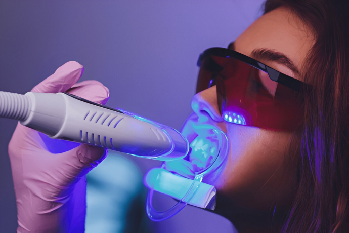 Teeth Whitening 