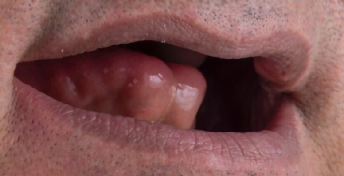 Dental Clinic Dental Implants