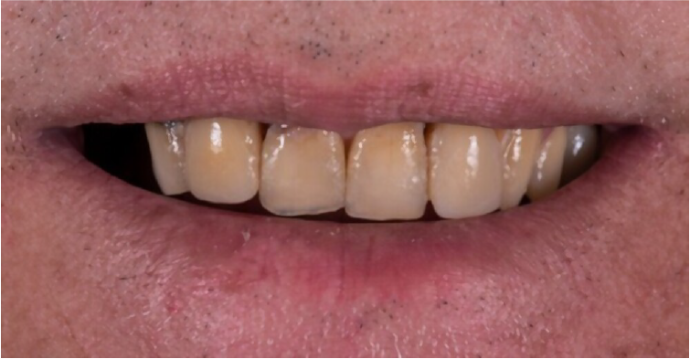 Dental Center Yellow Teeth