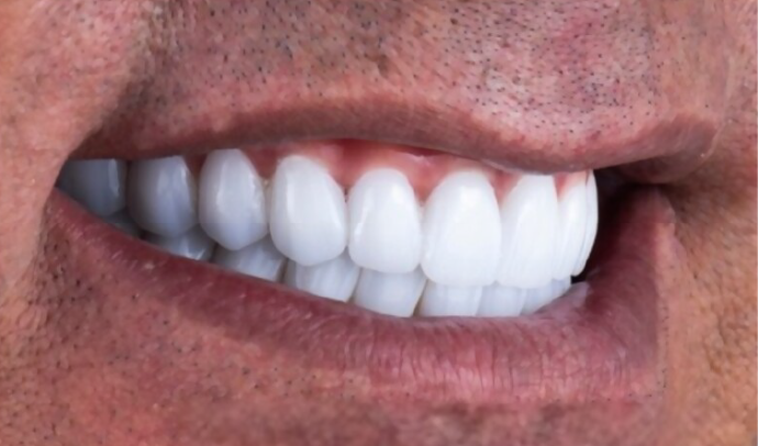 Dental Clinic Dental all on 4