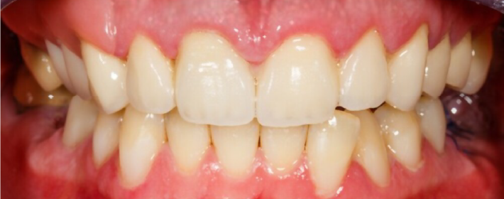 Dental Clinic Dentist near me