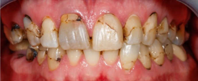 Dental Center Dental implant specialist