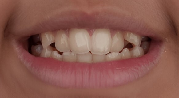 Dental Clinic Orthodontic Devices