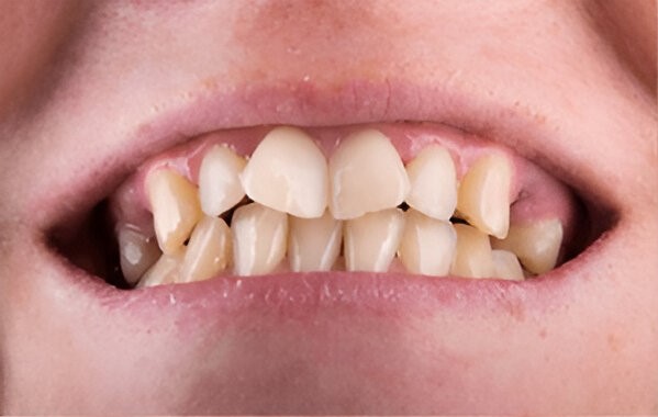 Dental Clinic Orthodontic braces