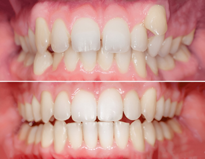 Dental Clinic transparent braces