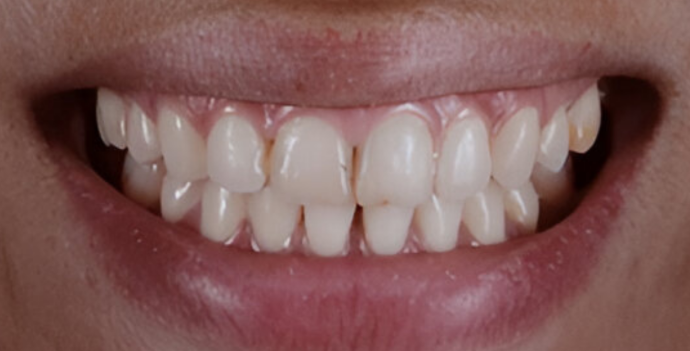 Dental Clinic dental lumineers