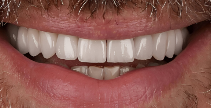 Dental center Hollywood smile