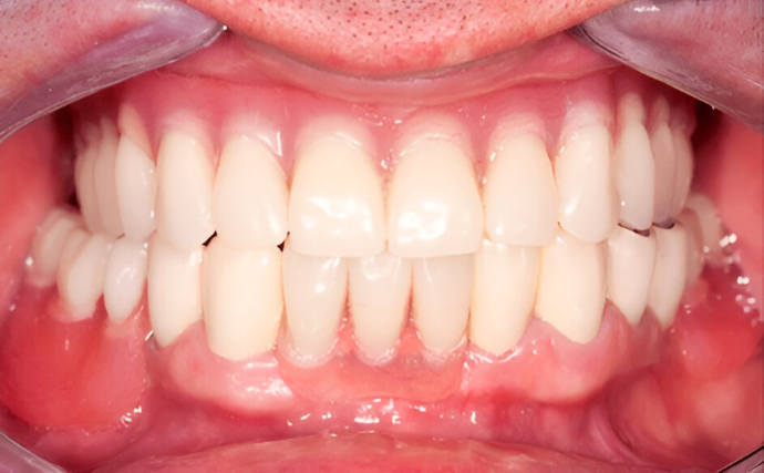 Dental Clinic Dental New teeth